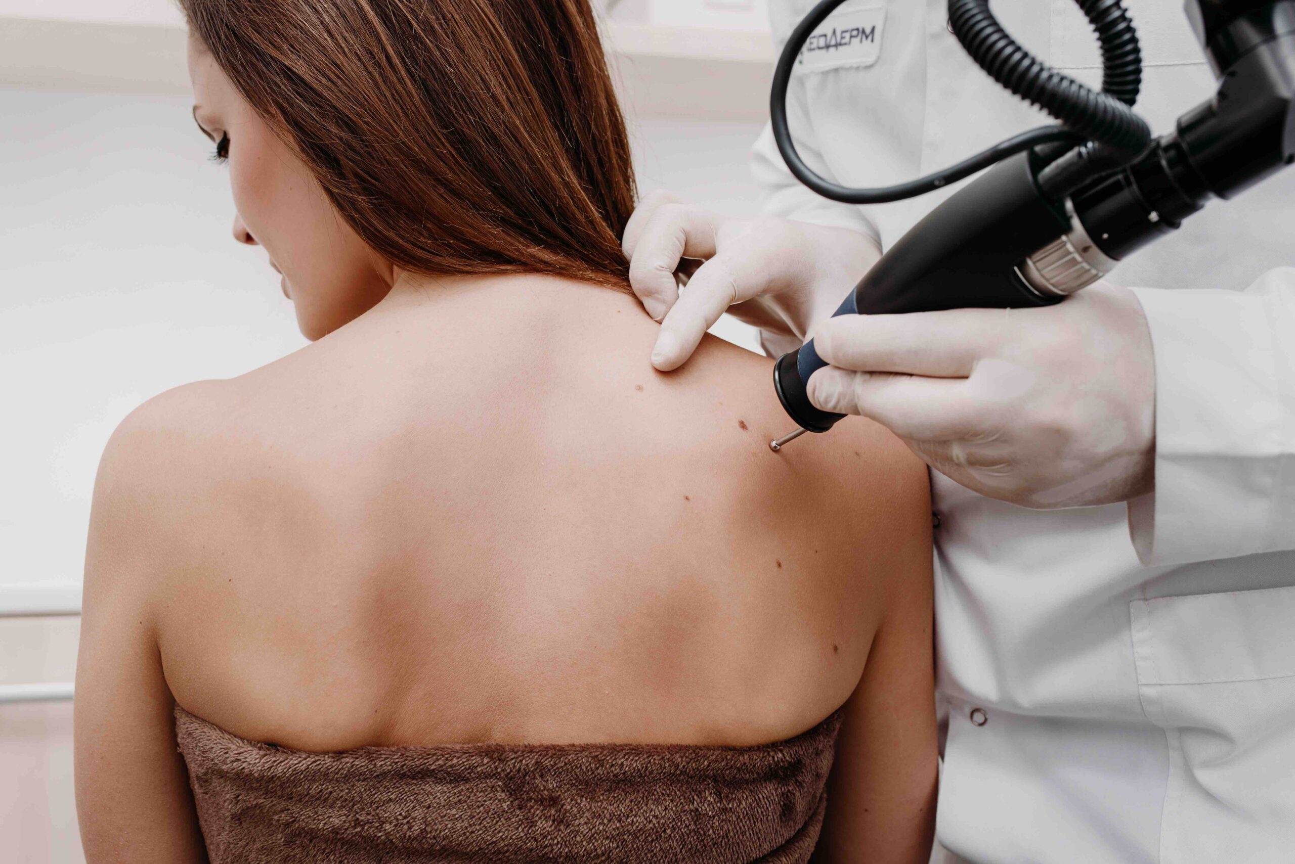 Doctor using dermatoscope on moles on woman's back.